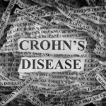 Crohn's Disease Explained: Symptoms, Risks & Treatment Options