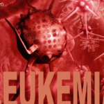 Fighting Back Against Leukemia: Treatment Options and a Positive Outlook